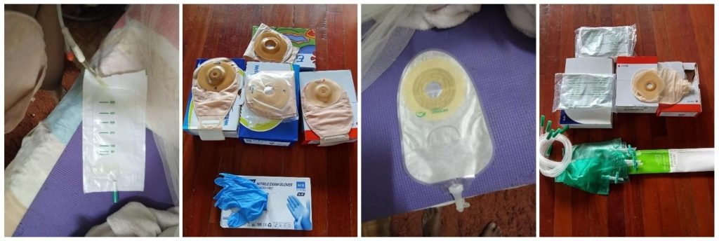 Stoma-/urinemateriaal zorgt voor nachtrust – Stichting Corantijn